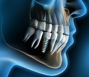 ankara dental klinik