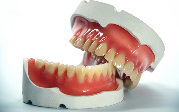 prothetischen zahn