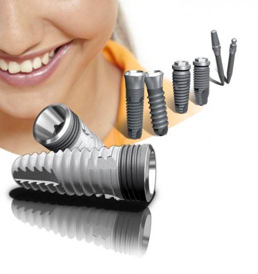 ankara dental implant